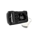 جهاز الفحص الترا بلس مع بروب كونفكس