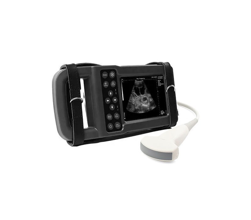 ss جهاز الفحص الترا بلس مع بروب كونفكس